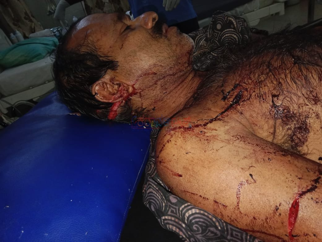 ನಿಟ್ಟೆ ಗ್ರಾಮದ ಪರಪ್ಪಾಡಿಯಲ್ಲಿ ಪತಿಗೆ ಮನಸೋಇಚ್ಚೆ ಕಡಿದು ಭೀಕರ ಹಲ್ಲೆ:ಕೃತ್ಯ ಮರೆಮಾಚಲು ಅಪರಿಚಿತ ವ್ಯಕ್ತಿಗಳು ಕೊಲೆಗೆ ಯತ್ನಿಸಿದರೆಂದು ಕಥೆ ಕಟ್ಟಿದ ಪತ್ನಿ!