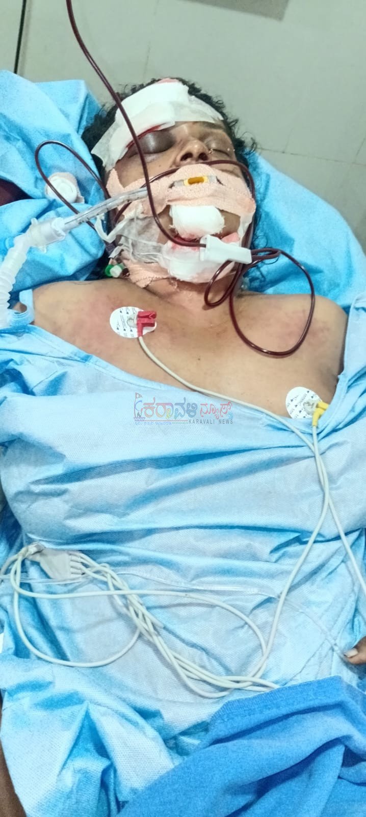 ನೂರಾಳ್’ಬೆಟ್ಟು: ಕೌಟುಂಬಿಕ ಕಲಹ ಹಿನ್ನೆಲೆ: ಪತಿಯಿಂದಲೇ ಪತ್ನಿಗೆ ಮಾರಣಾಂತಿಕ ಹಲ್ಲೆ, ಮಹಿಳೆ ಗಂಭೀರ